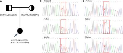 Late-Onset Bartter Syndrome Type II Due to a Novel Compound Heterozygous Mutation in KCNJ1 Gene: A Case Report and Literature Review